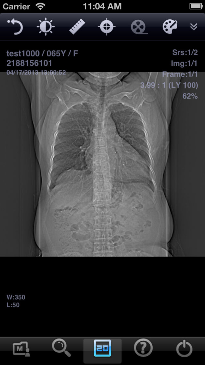 INFINITT Mobile Viewer