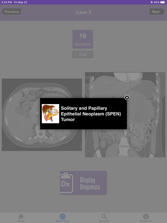 Screenshot #6 pour CTisus Challenge: The Pancreas