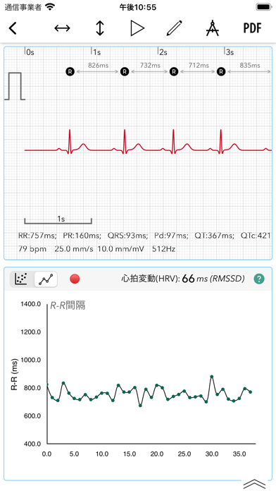 ECG+スクリーンショット