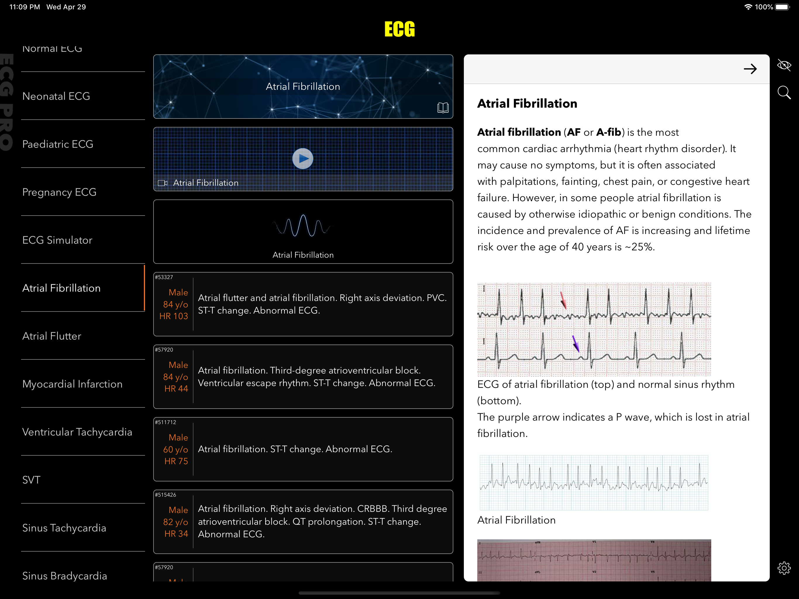 ECG Pro for Doctors