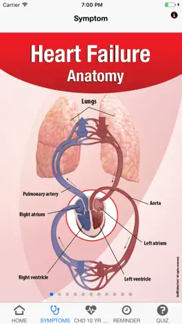 Game screenshot Signs & Symptoms Heart Failure apk