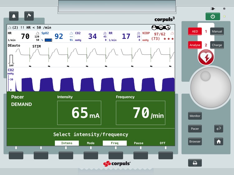 corpuls simulation screenshot-3