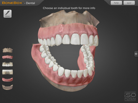 Screenshot #4 pour BoneBox™ - Dental Pro
