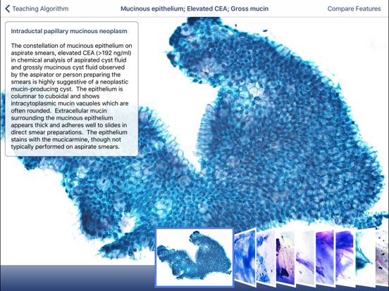 Johns Hopkins Atlas of Pancreatic Cytopathologyのおすすめ画像3