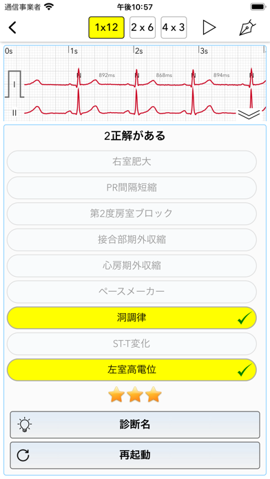 ECG Testのおすすめ画像4