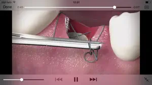 The Oral Surgery Suture Trainer screenshot #2 for iPhone