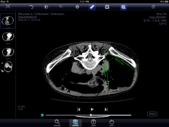 Screenshot #6 pour INFINITT Mobile Viewer HD