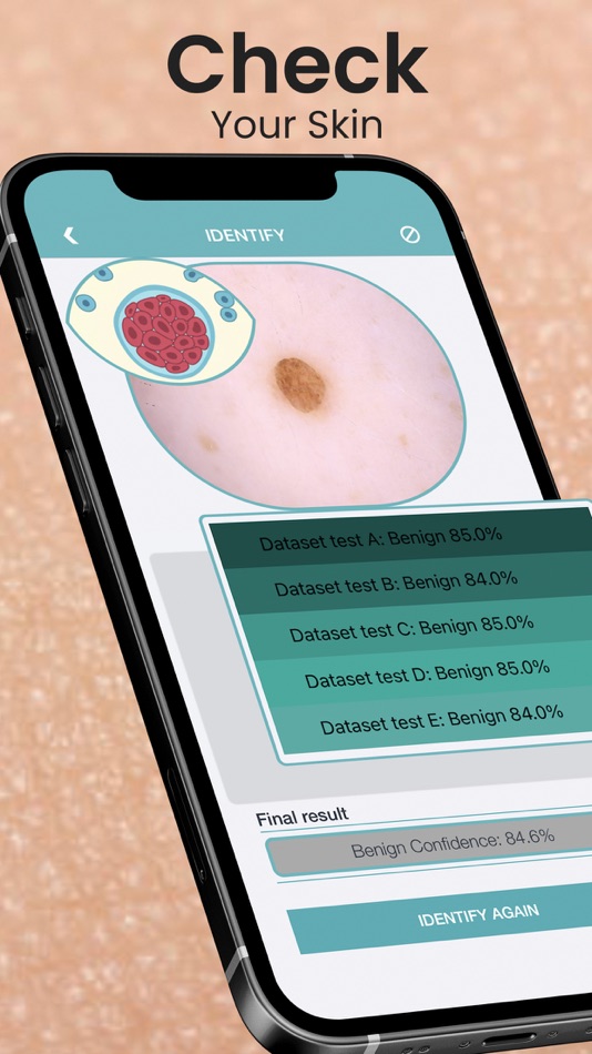 Mole Checker Skin Dermatology - 4.8 - (iOS)