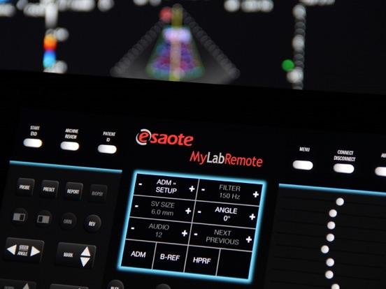 Screenshot #4 pour MyLabRemote