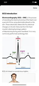 ECG for Doctors screenshot #10 for iPhone