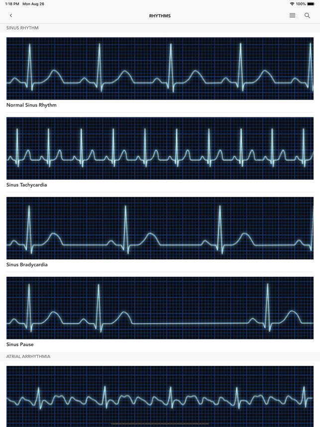 Instant ECG - Mastery of EKG su App Store