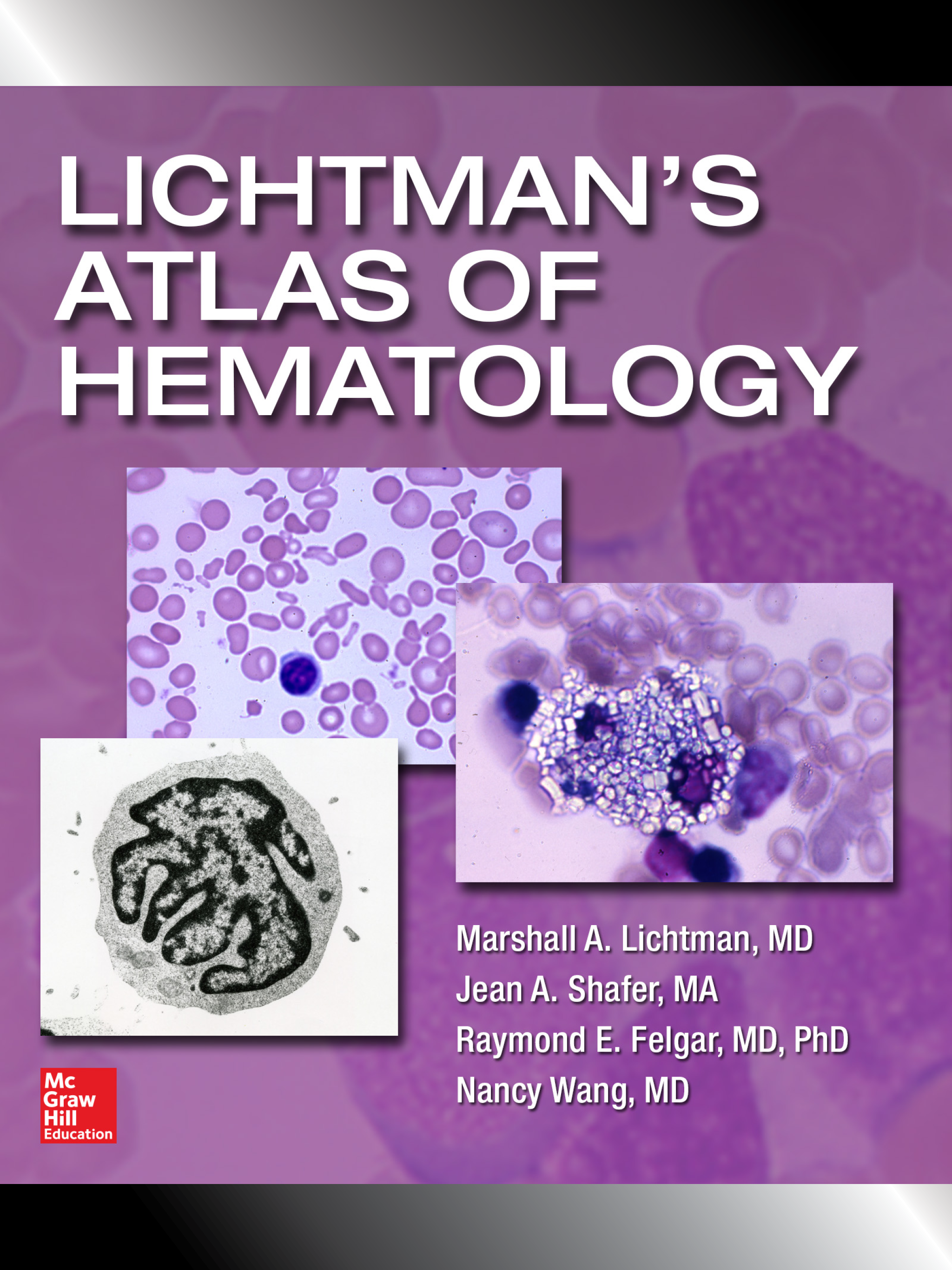 Lichtman's Atlas of Hematology screenshot 6