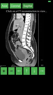 ct abdomen pelvis iphone screenshot 3