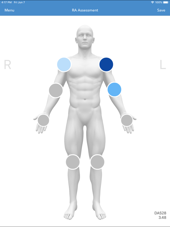 Screenshot #4 pour cliexa-RA