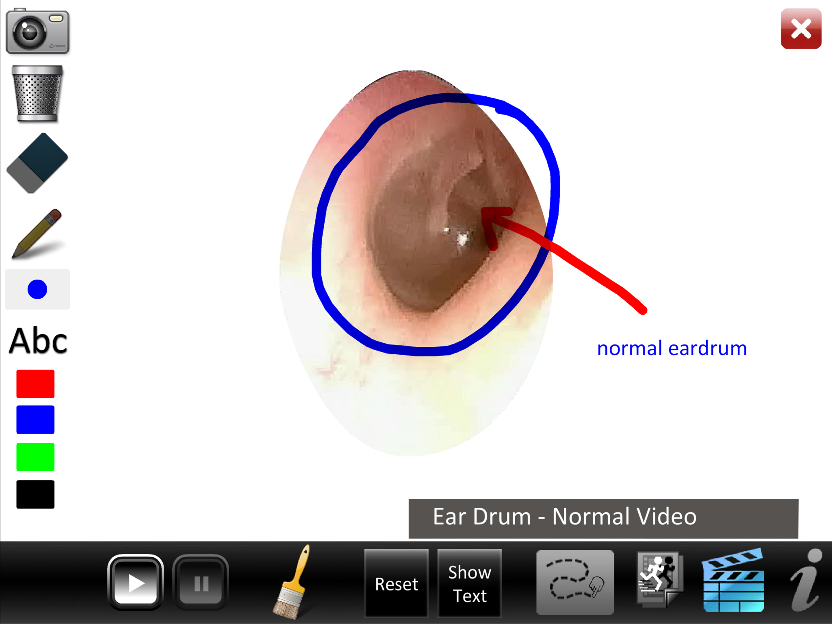 Ear ID screenshot 10