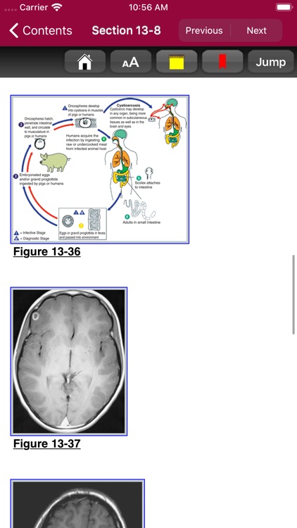 Atlas of Pediatric ER Med, 3/E screenshot-5