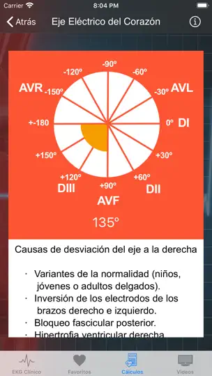 Captura de pantalla de EKG Clínico en iPhone 7