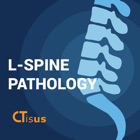 CTisus L-Spine Pathology