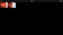 Game screenshot minimirror oral endosope hack