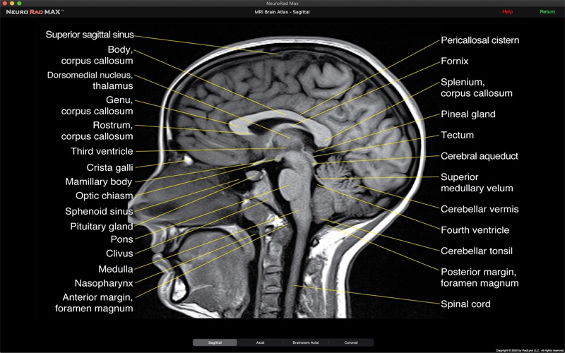 Screenshot #2 pour NeuroRad Max