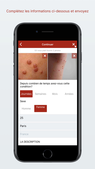 Screenshot #2 pour STD (MST) Triage Dermatologue