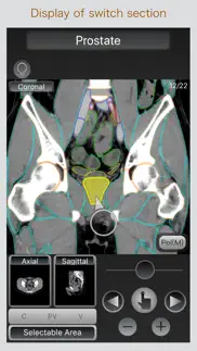 ct passport abdomen iphone screenshot 4