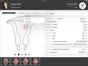 imagyn for iCare screenshot 3