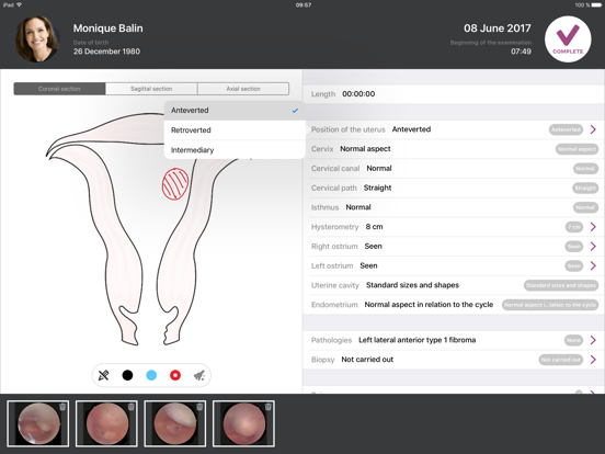 imagyn for iCare app screenshot 3