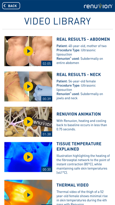 Renuvion iPhone screenshot 5 - Medical app
