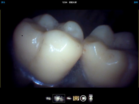 DentalShotのおすすめ画像9