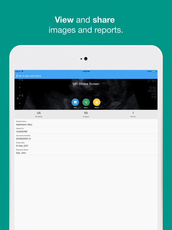 MR iVue iPad screenshot 4 - Medical app