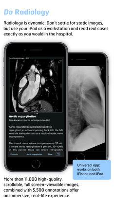 Thoracic Imaging Fundamentals screenshot 3