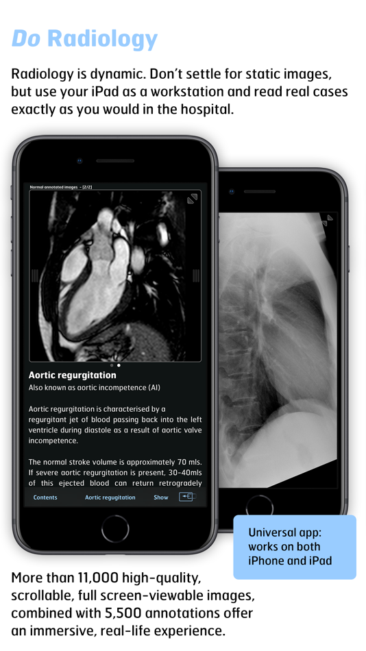 #3. Thoracic Imaging Fundamentals (iOS) Bởi: BestApps BV