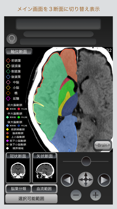 CT Passport 頭部のおすすめ画像4