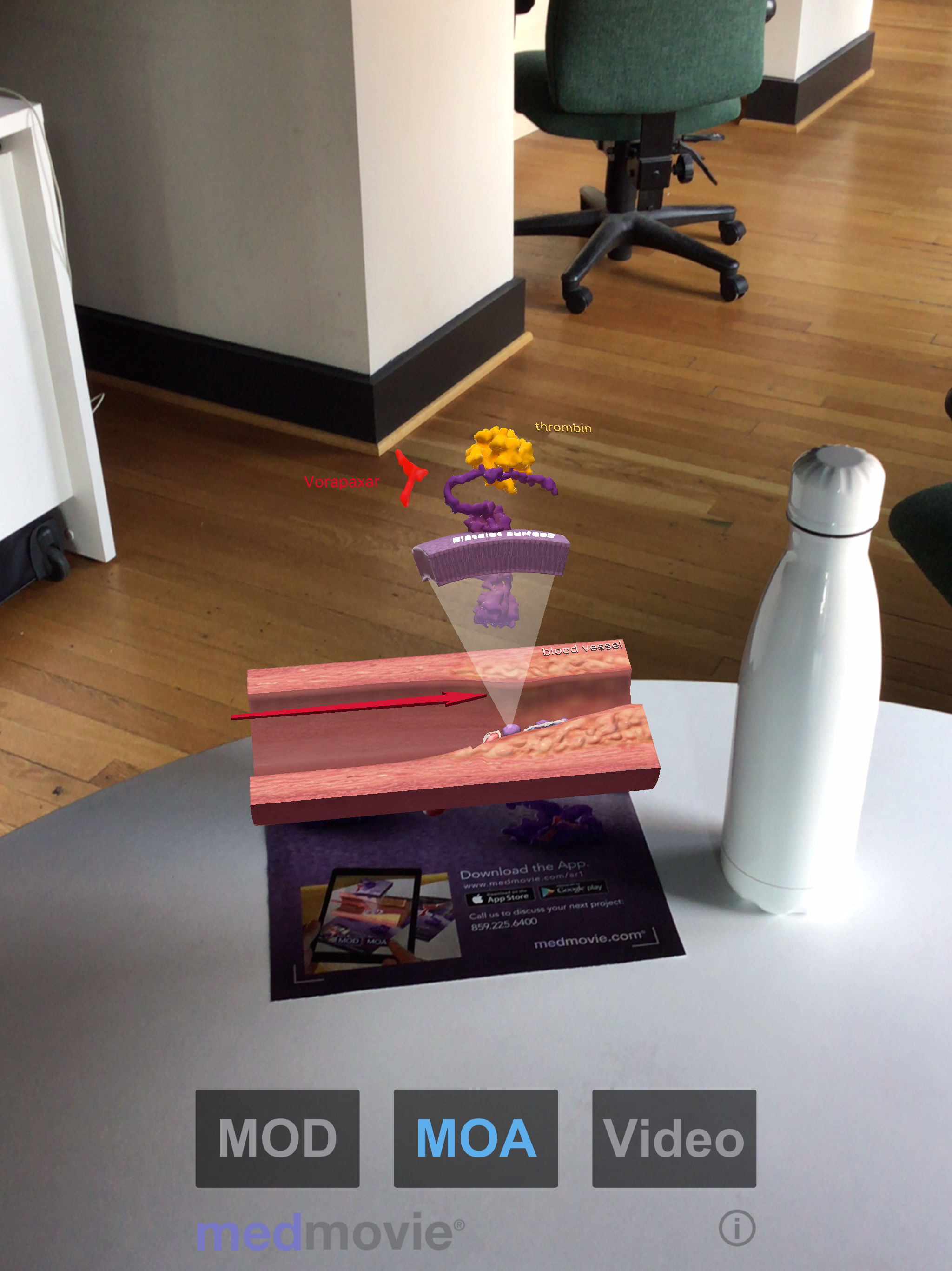 Medmovie AR1
