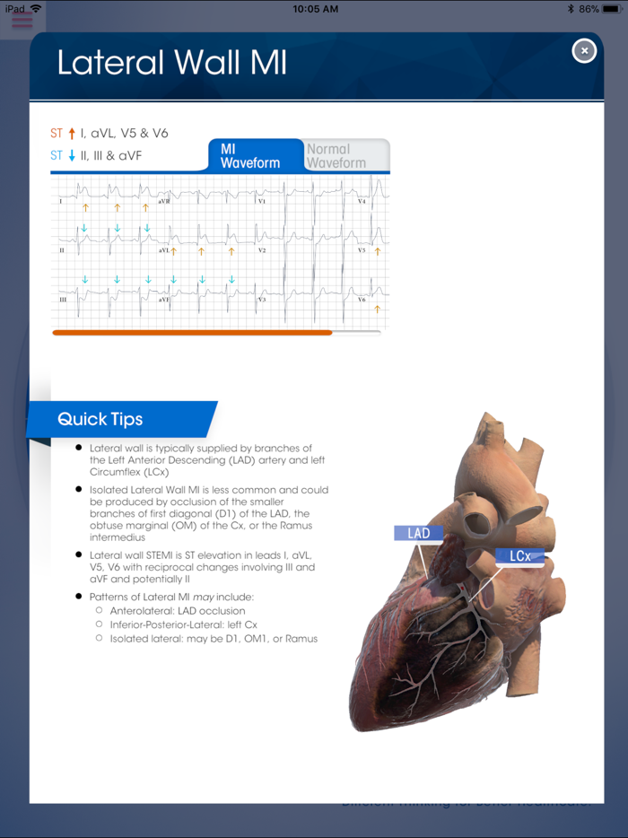NK 12-Lead ECG Wheel