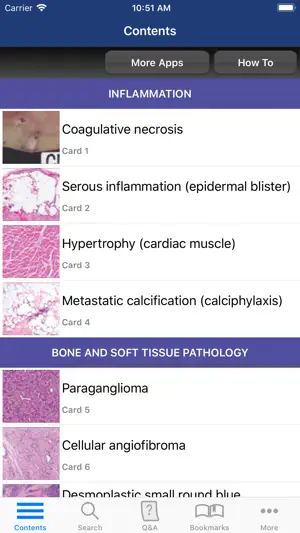 Anatomic Pathology Flashcards screenshot 2