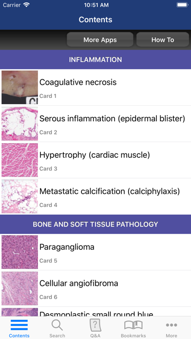 Anatomic Pathology Flashcards Screenshot