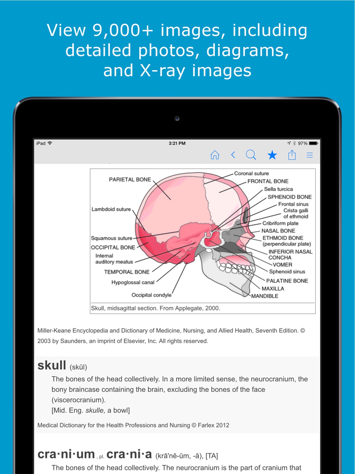 Nursing Dictionary by Farlex ipad screenshot 3