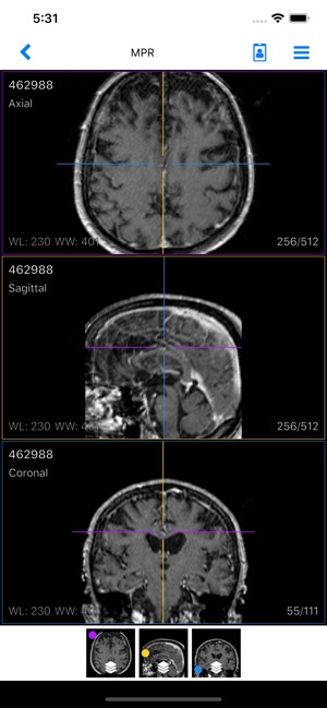 IMAIOS Dicom Viewer(圖2)-速報App