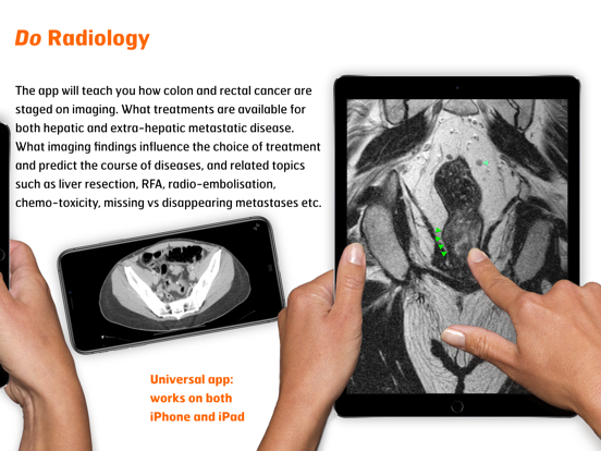 Screenshot #6 pour Radiology - CRC Staging Atlas