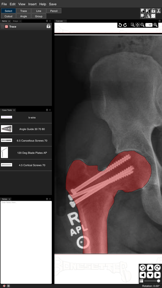 Bonesetter Learning screenshot