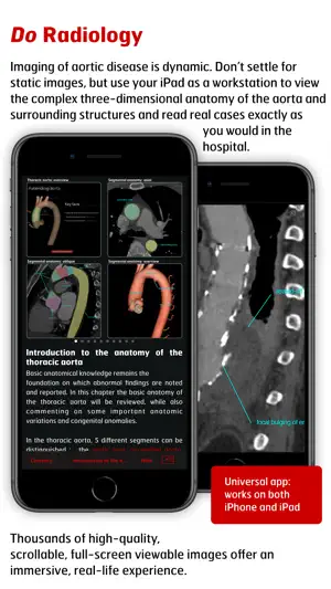 Radiology - Aortic Imaging screenshot 3