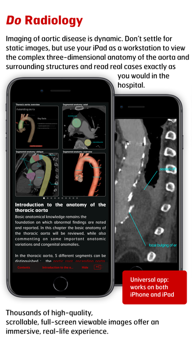 Screenshot #3 pour Radiology - Aortic Imaging