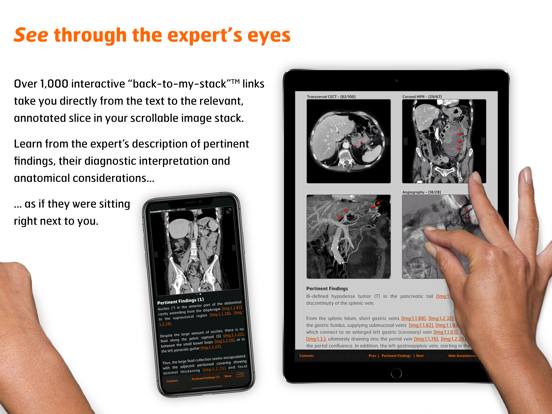 Radiology - Abdomen Dynamic iPad app afbeelding 4