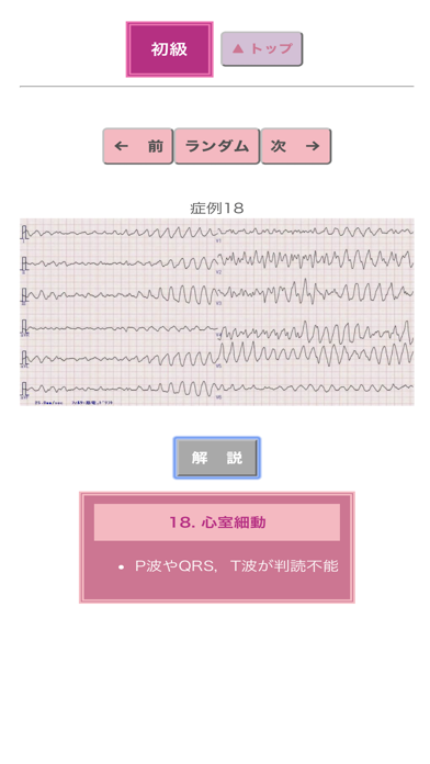 ポケット心電図のおすすめ画像4