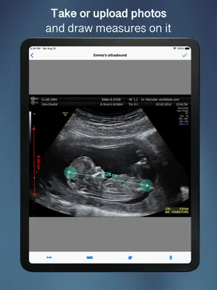 Captura 1 Image Ruler - Measures iphone