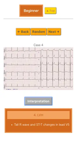 Game screenshot Pocket ECG apk