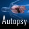 Educational autopsy video, Q&A, case discussions and live streams
