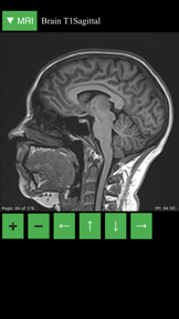 MRI Viewer screenshot